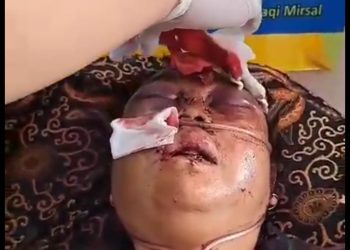 Betaherti, Korban Perampokan Sadis di Kota Solok Dirujuk ke M. Djamil Padang