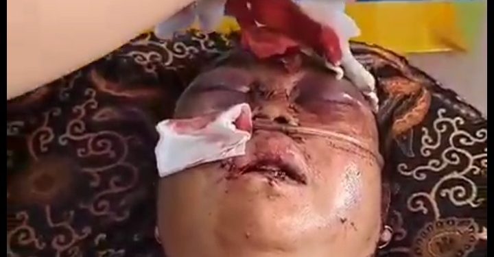 Betaherti, Korban Perampokan Sadis di Kota Solok Dirujuk ke M. Djamil Padang